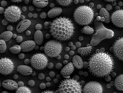 Pollen-Electron-Microscope-Allergy-Causing