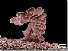 Celiac-disease-bacteria-overgrowth-gluten-free-diet-E_coli_10000x